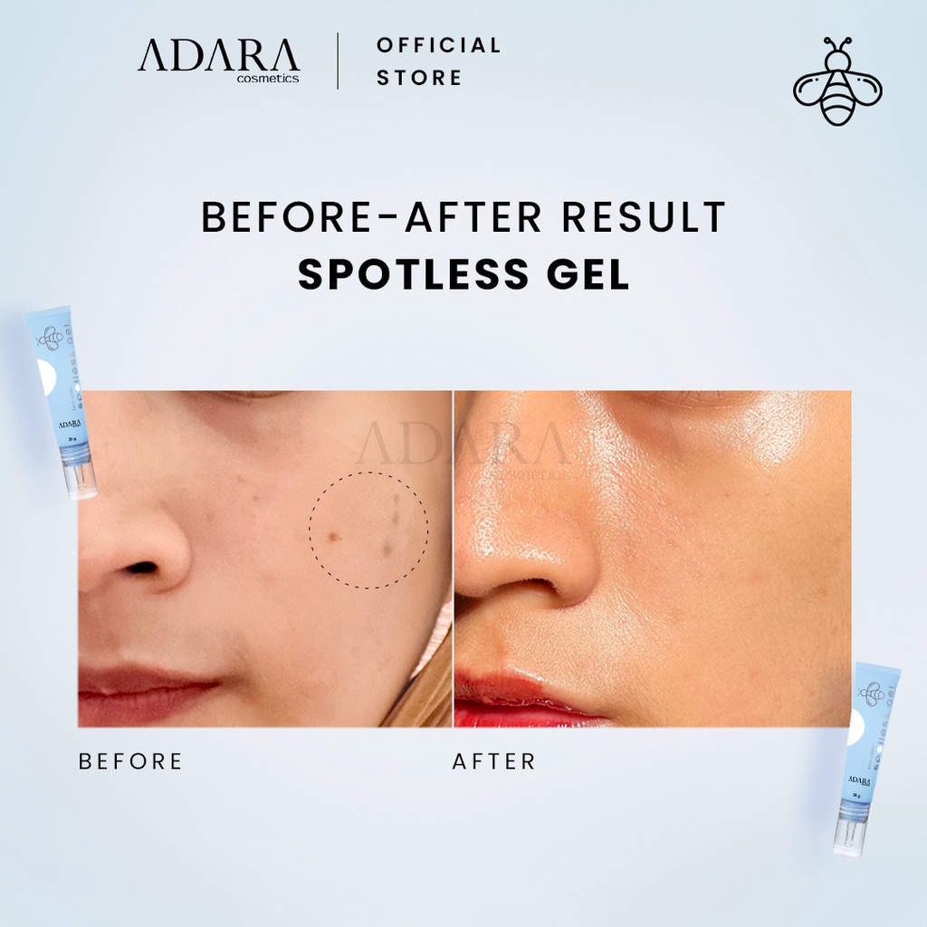 Adara Bee White Spotless Gel | Cream 20g