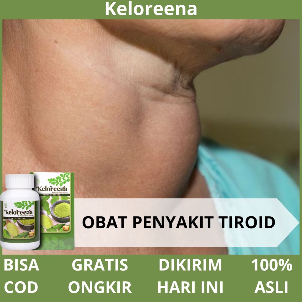 Obat Kelenjar Tiroid Di Leher - Obat Penyakit Benjolan Tiroid Bengkak, Pembengkakan Tiroid, Penghanc
