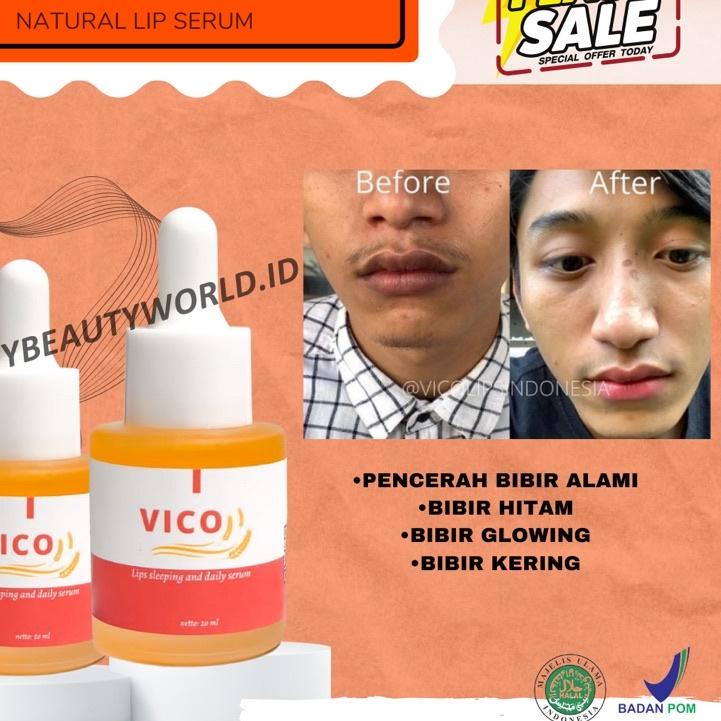 ➭ VICO LIPS SERUM BIBIR ORIGINAL | PENCERAH BIBIR | SERUM BIBIR | PEMERAH BIBIR | PEMERAH BIBIR PERM