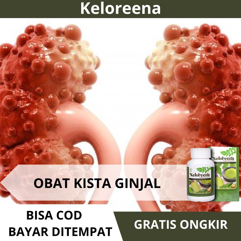 Obat Kista Ginjal - Penghancur Benjolan Kista Dalam Ginjal, Penghilang Polip Ginjal, Menghilangkan T