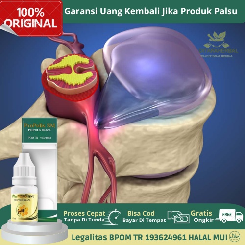Obat Nyeri Saraf Kejepit, Obat Saraf Kejepit Tulang Belakang, Obat Saraf Kejepit, Obat Herbal Saraf 