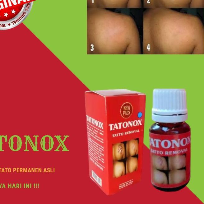 ◄ TATONOX ASLI / PENGHILANG TATO PERMANEN / PENGHILANG TATO ♦