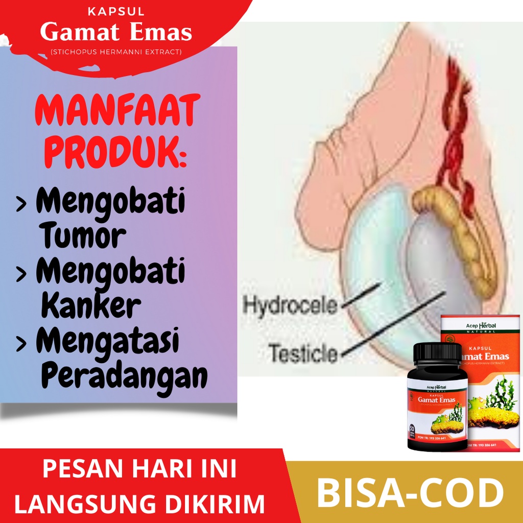 Obat Buah Zakar Bengkak Sebelah Kanan/Kiri, Obat Buah Zakar Turun Sebelah, Obat Buah Zakar Sakit, Ob