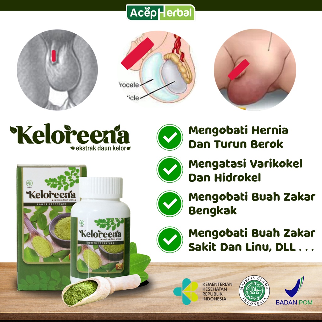 Obat Buah Zakar bengkak, Hernia, Varikokel, Hidrokel, Benjolan pada testis, Benjolan Kelamin, Biji Z