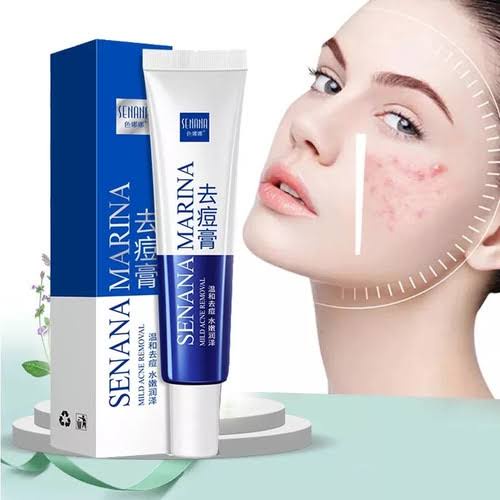 SENANA MARINA KRIM PENGHILANG JERAWAT 30g CREAM KECANTIKAN WAJAH TREATMENT