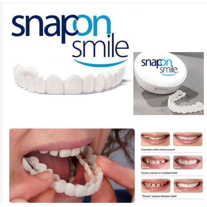 Snap On Smile 100% ORIGINAL Authentic Perawatan Kesehatan Gigi Palsu Renggang Snapon Smile 1 Set