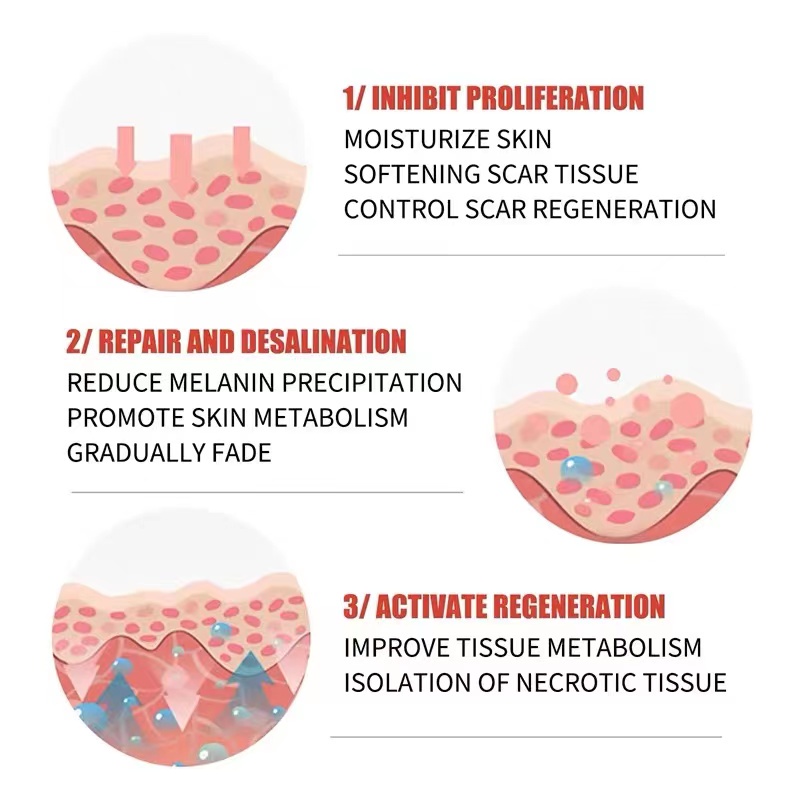 Cream penghilang bekas luka Menghilangkan bekas luka Salep penghilang bekas luka 20g Bekas jerawat/bekas luka bakar/bekas luka operasi/bekas luka operasi caesar/stretch mark/Permanen / Original / Cocok untuk orang di atas 6 tahun