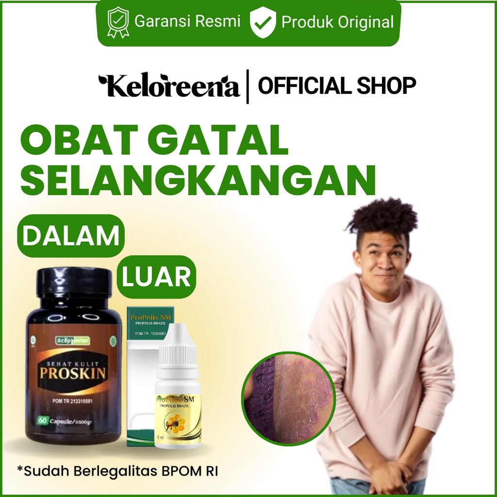 Obat Gatal Selangkangan Eksim dan Jamur Paling Efektif Kurap di Selakangan Hitam Dekat Area Alat Kel