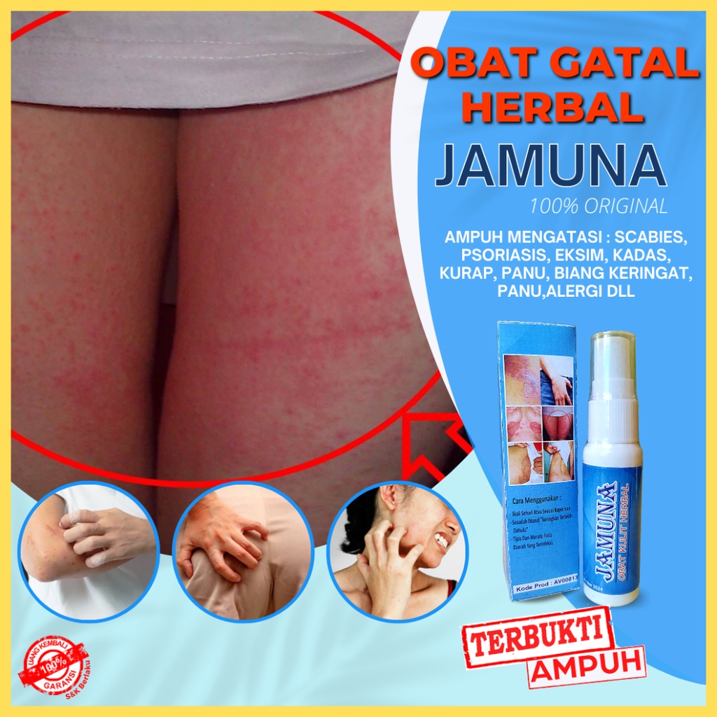 OBAT EKSIM KULIT GATAL SELANGKANGAN JERAWAT JAMUR KUDIS KURAP KUTU AIR BERI BERI JAMUNA HERBAL