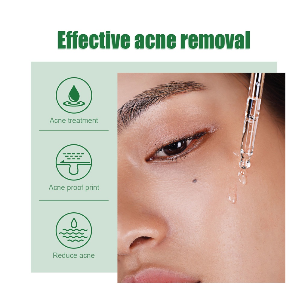 ALLPHV Tea Tree Acne Treatment Repair Skin Acne Serum menyembuhkan jerawat 17ml