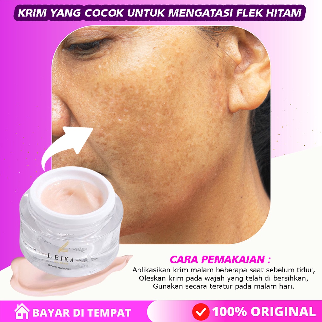 [ PALING AMPUH ] Cream flek melasma ampuh aman flek hitam bopeng bpom dokter ori bpom krim farma dok