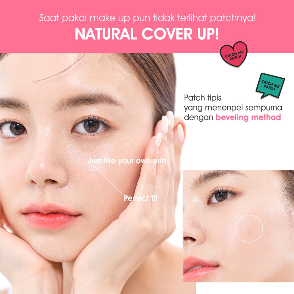 Catch me patch - Superior Pimple Patch Box 60pcs