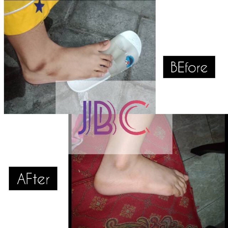 pemutih mata kaki by joliestore.20