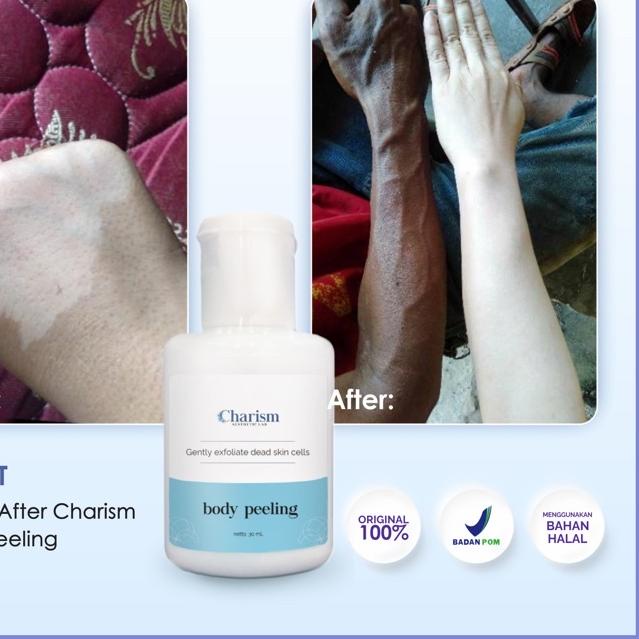 ♡ AHA 10% - BODY PEELING SOLUTION - PENGELUPASAN KULIT BADAN ☇