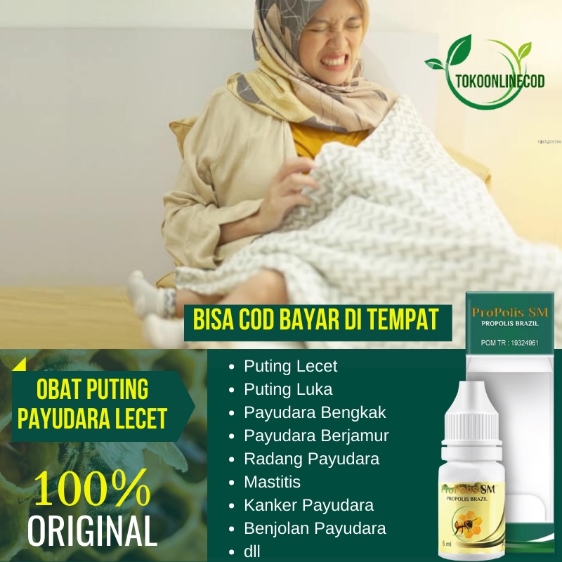 Obat Lecet Luka Puting Payudara , Obat Salep Oles Puting Lecet Akibat Menyusui , Puting Payudara Luk