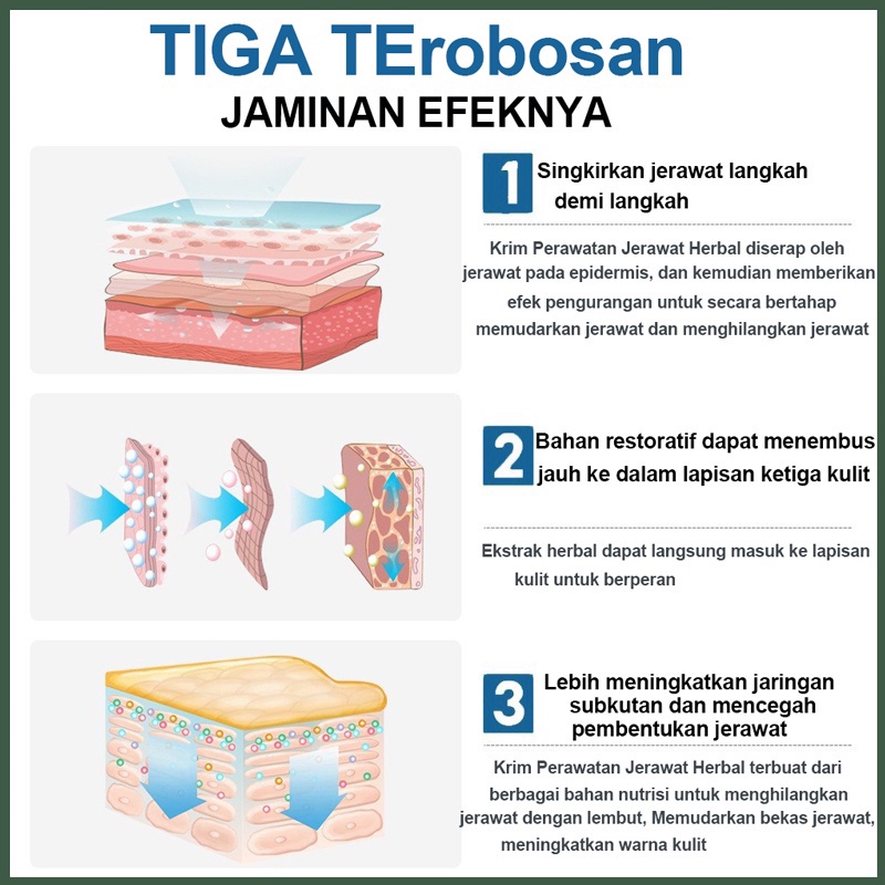 Penghilang jerawat Serum Gel jerawat Perawatan jerawat wajah Serum wajah acne 20G Menghilangkan jerawat, Bekas jerawat, Memudarkan bekas jerawat Esensi herbal Dengan lembut, aman dan cepat menghilangkan semua jenis jerawat dan bekas jerawat