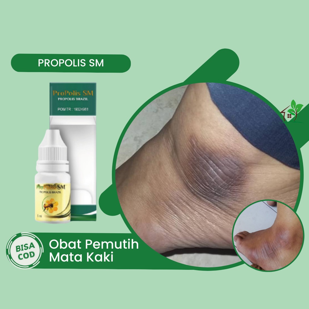 Obat Pemutih Mata Kaki Yang Hitam, Obat Mata Kaki Hitam dan Kasar, Obat Mata Kaki Hitam Kapalan, Oba