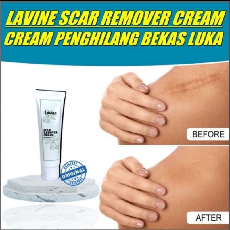 BESS SELLER || LAVINE SCAR REMOVER CREAM Penghilang Bekas Luka