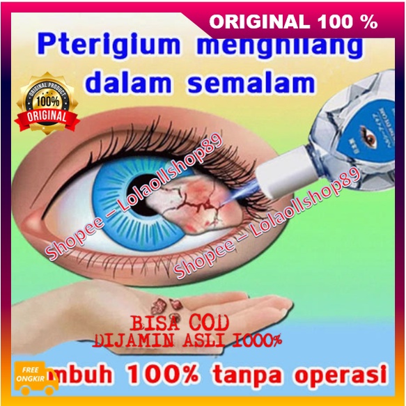 Obat Tetes Mata Pterigium  Menghilang Dalam Semalam Glaukoma , Katarak , Rabun Jauh Ampuh 100% ASLI 