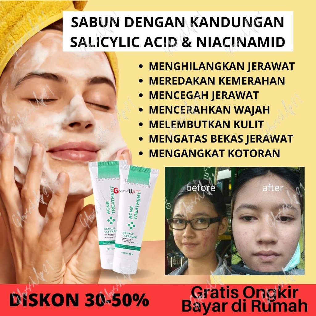 SABUN WAJAH PENGHILANG JERAWAT DAN BEKAS JERAWAT HANASUI ACNE TREATMENT GENTLE CLEANSER 60GR SABUN WAJAH HANASUI ACNE