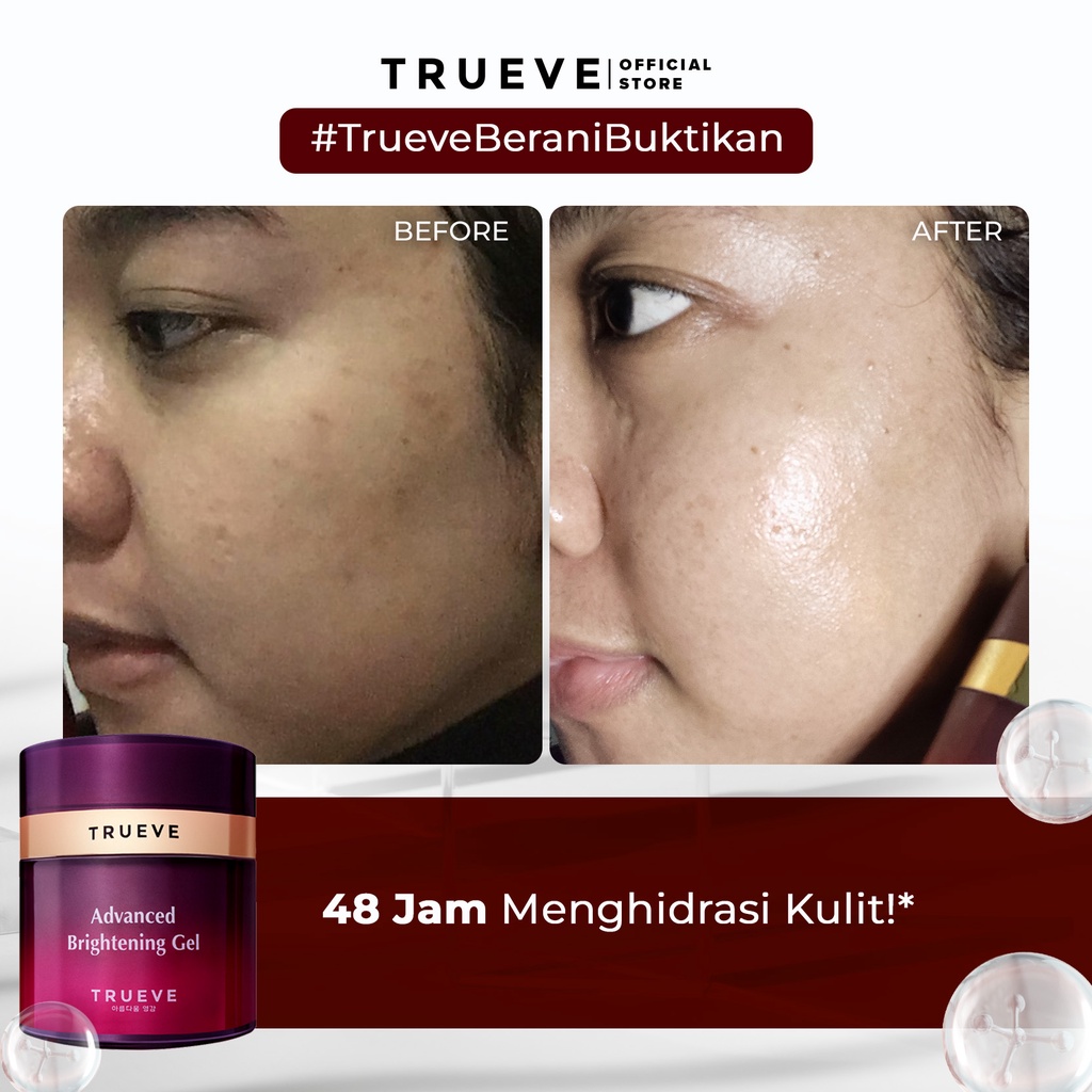 TRUEVE Advanced Brightening Gel (Premium Vitamin C (VCIP Dari Jepang) + 6X Ceramide - Moisturizer Gel Perawatan &amp; Pelembab Wajah Pagi Malem, Menjaga Skin Barrier Cocok Untuk Semua Jenis Kulit Wajah Kulit Kusam)