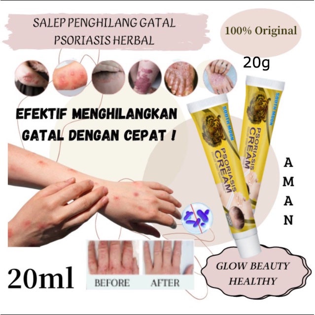 Salep gatal Salep kulit Krim perbaikan gatal kulit Krim psoriasis 20g Salep eksim Bahan obat Cina yang sehat Pengobatan penyakit kulit Menghambat infeksi jamur Kulit gatal Kudis kulit kurap Dermatitis Eritema Beri-beri Gatal Psoriasis