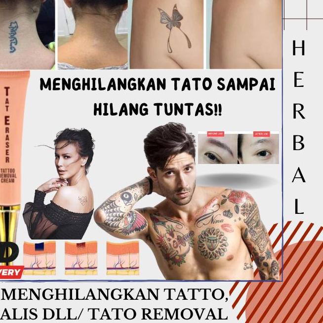 ☻ Krim Penghilang tatto tato removal ♗