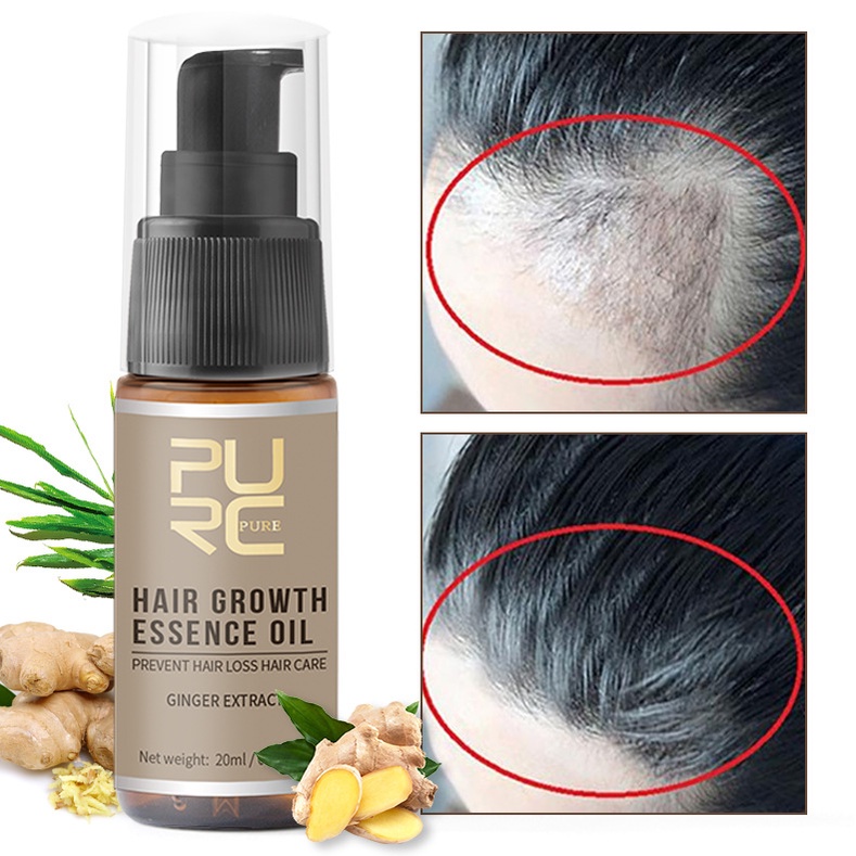 Obat Rambut Rontok Ampuh PURC Original Pria Wanita Pertumbuhan Rambut Esensi Pertumbuhan Cepat Serum