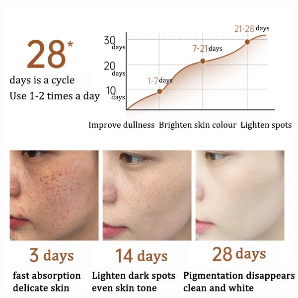 Serum anti flek Serum flek hitam Menghilangkan flek hitam Cream penghilang flek hitam Serum anti aging Perawatan wajah 100ML Whitening freckle cream Bintik menghilangkan chloasma, flek, flek hitam, bintik, bintik-bintik penuaan