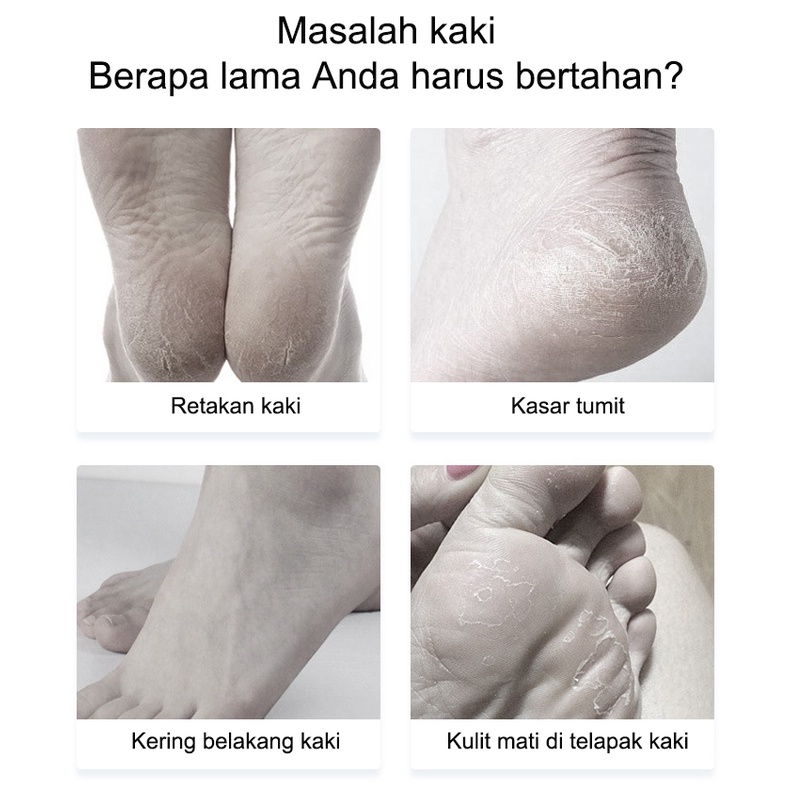 Obat Kaki Pecah Dan Kering Foot Cream Cream Krim Masker Penghilang Kaki Pecah Dan Kering 50g / cream untuk kulit kaki pecah-pecah /Perawatan Kaki Penghalus Tumit