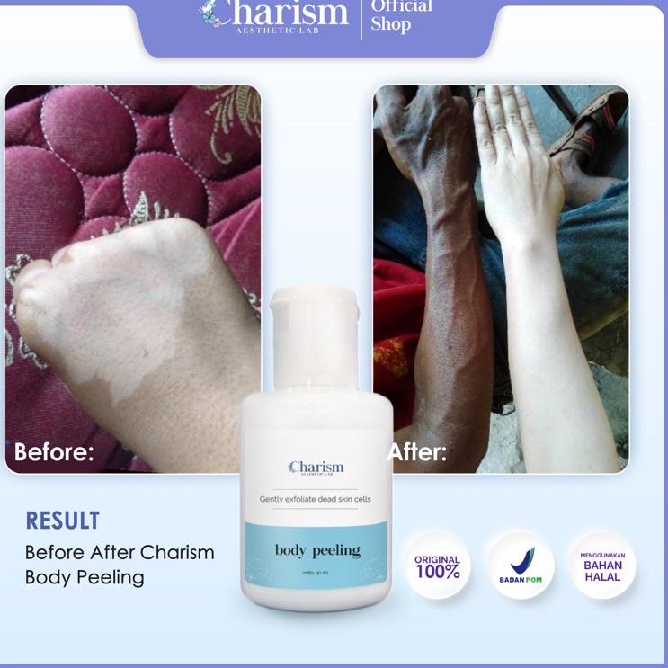 ✶ AHA 10% - BODY PEELING SOLUTION - PENGELUPASAN KULIT BADAN ☏