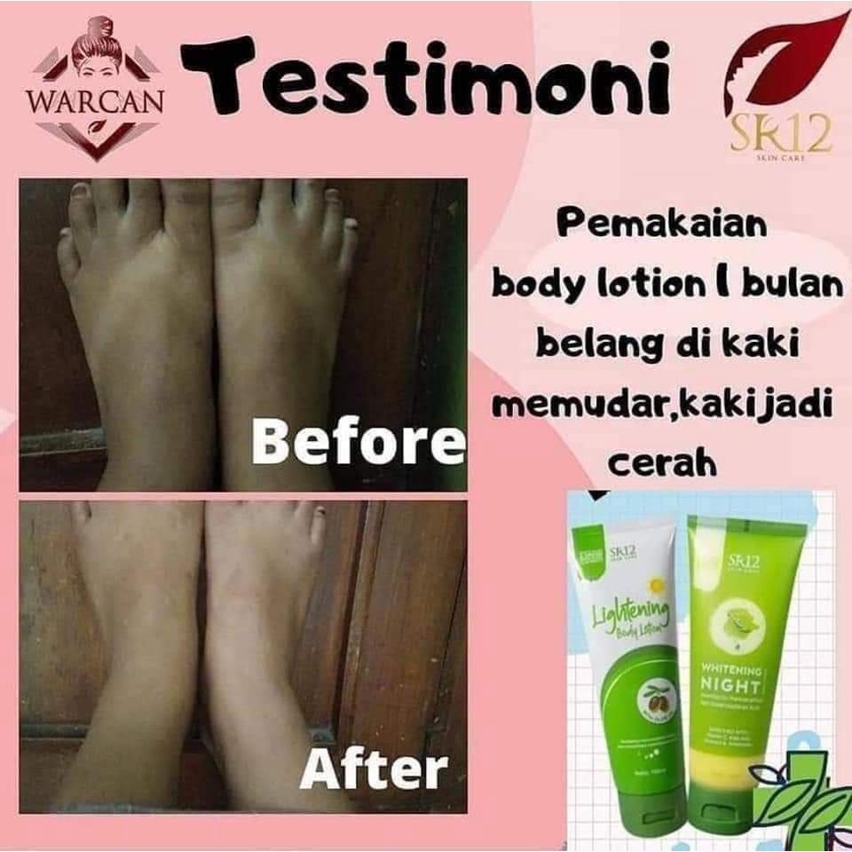 Lightening Body Lotion SR12 Lotion Pencerah Melindungi Kulit dari Sinar UV SPF 30++ dan Antioksidan