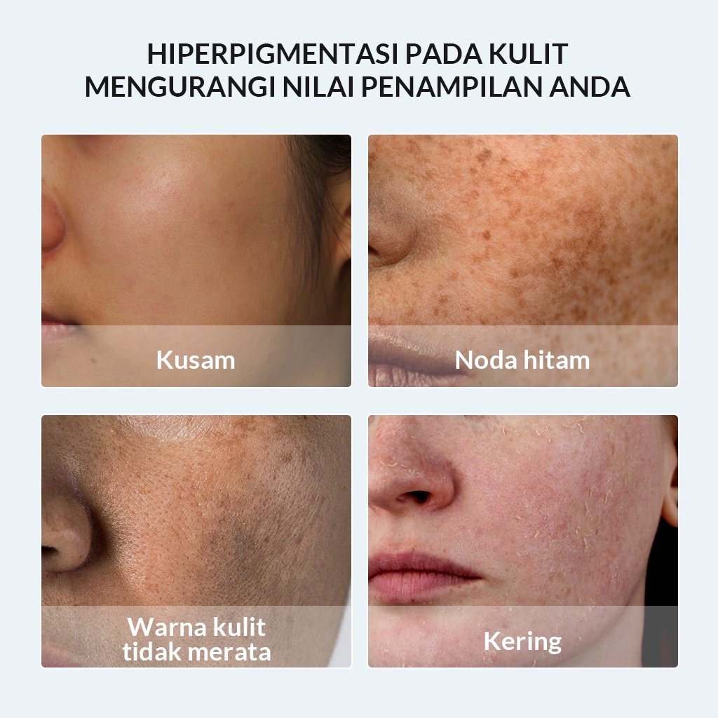 BIOAQUA Symwhite 377 Whitening &amp; Fade Dark Spot Toner 120mL