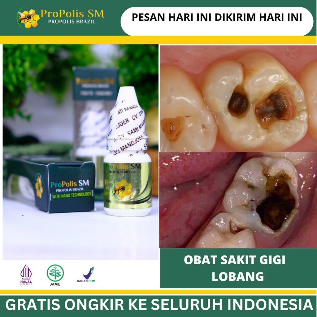 Obat Gusi Nyeri, Gusi Bernanah, Gusi Berlubang, Gusi Bengkak, Obat Gusi Berdarah, Penguat Akar Gigi,