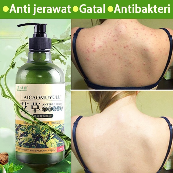 Sabun jerawat Sabun penghilang jerawat badan Sabun pemutih badan Antibakteri Antipruritik Menghilangkan jerawat Menghilangkan tungau punggung dan menghilangkan jerawat Wangi yang tahan lama dan jenis yang menyegarkan