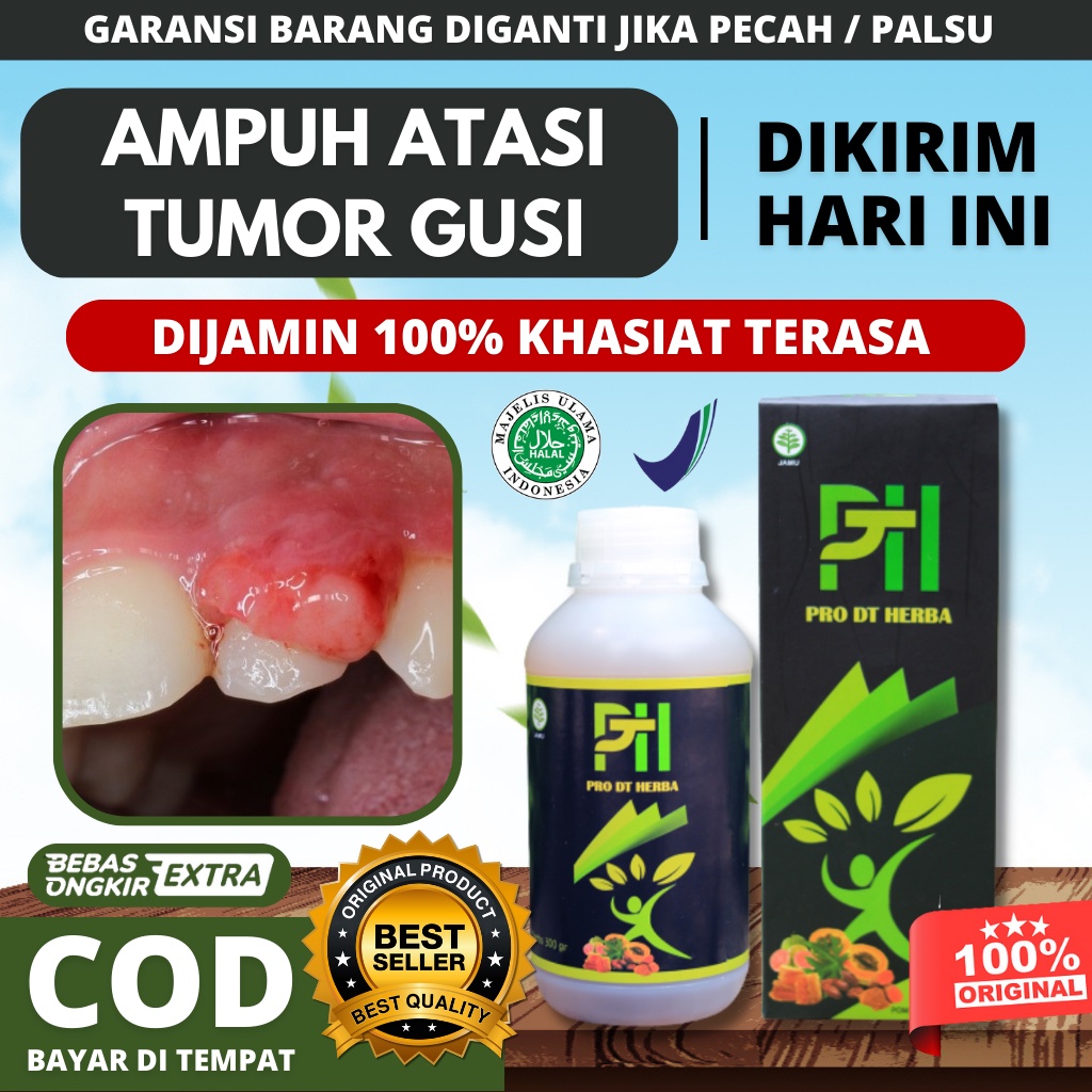 Obat Tumor Gusi - Gusi Bengkak - Bau Mulut - Penghilang Benjolan Gusi - Gusi Berdarah - Infeksi - Gu