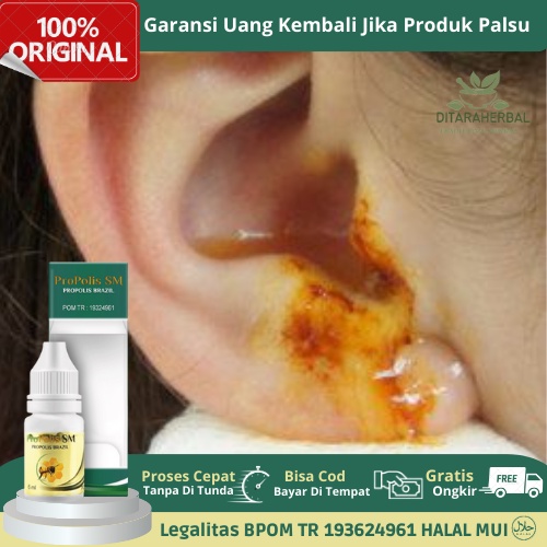 Obat Telinga Congek, Obat Telinga Congek Berair, Obat Telinga Bau, Obat Telinga Bernanah, Obat Telin