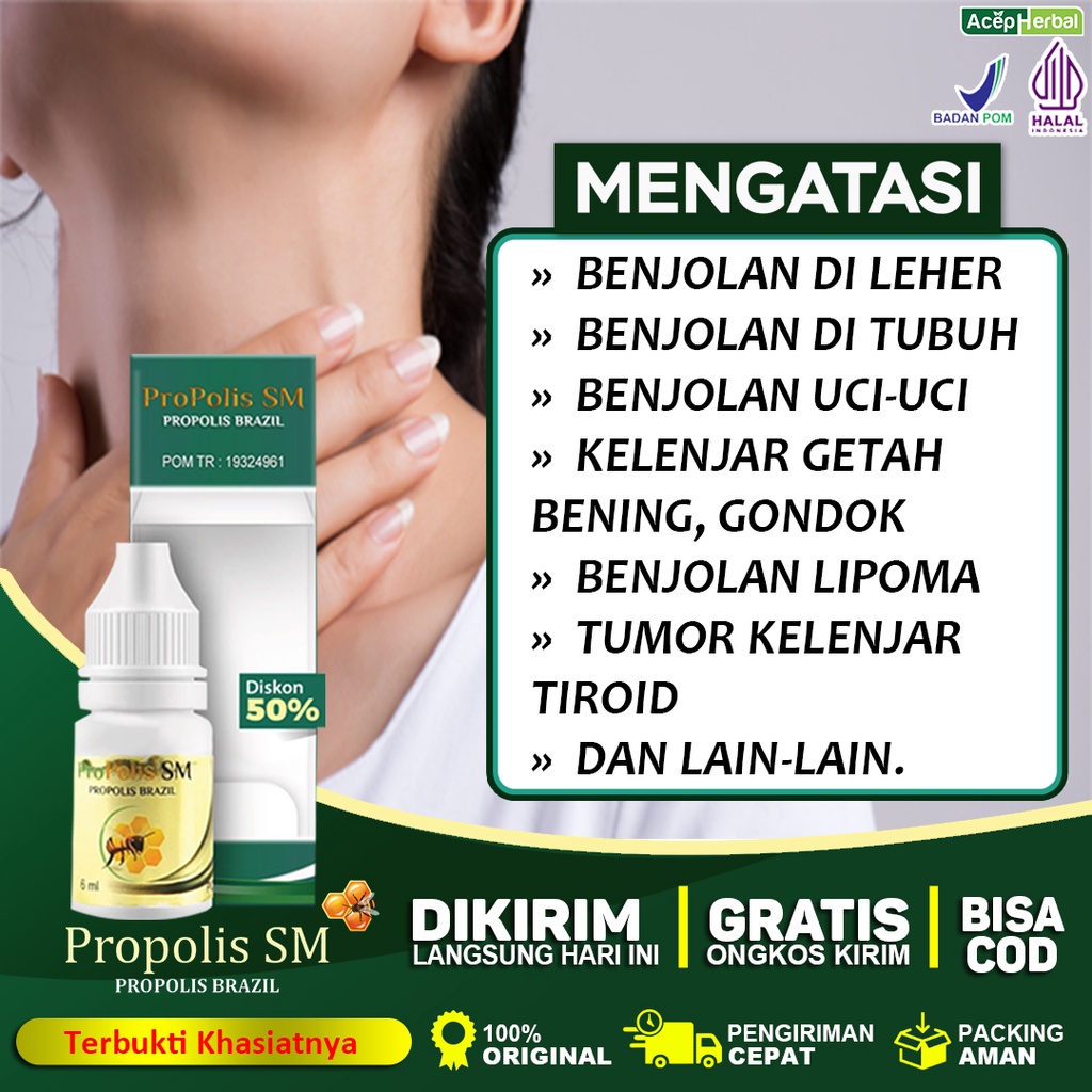 Jual Obat Benjolan Di Leher Penghancur Benjolan Di Leher Kelenjar Getah ...