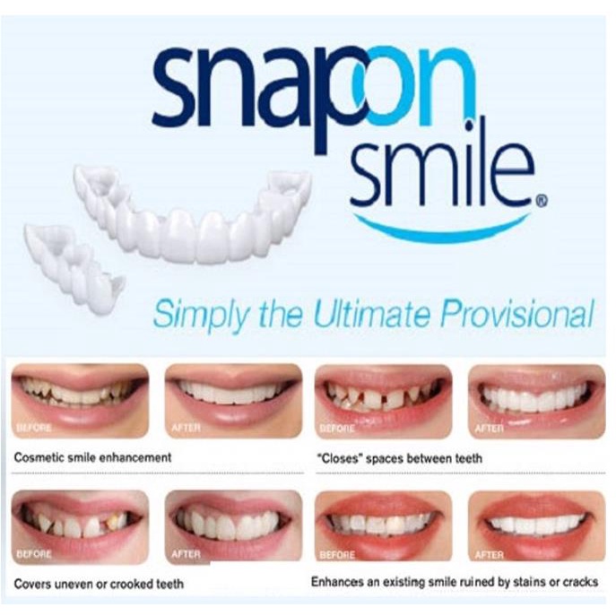 Snap On Smile 100% ORIGINAL Authentic Perawatan Kesehatan Gigi Palsu Renggang Snapon Smile 1 Set