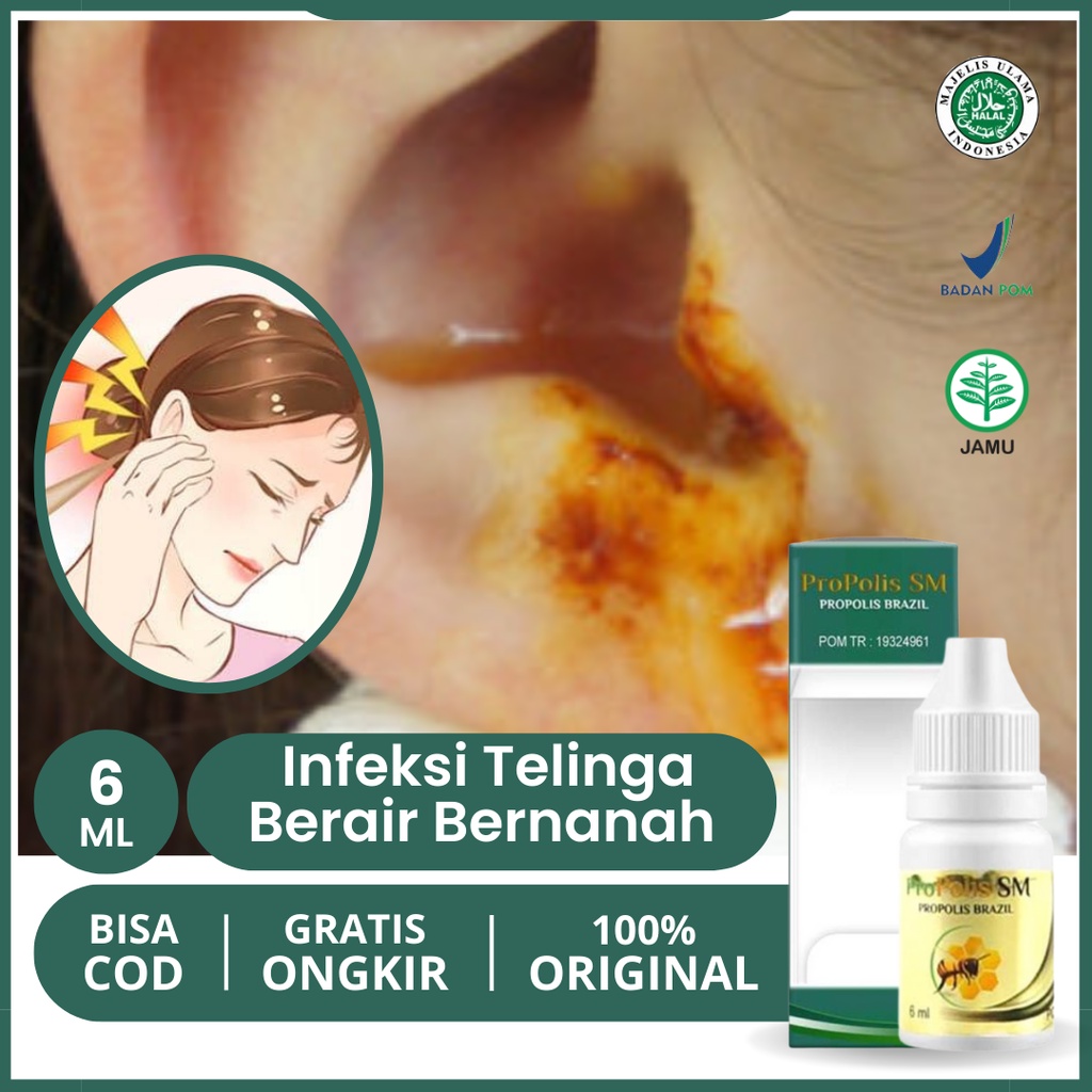 Obat Tetes Telinga Budeg Berdengung Gatal Berair Infeksi Telinga Gangguan Pendengaran Telinga Bernan