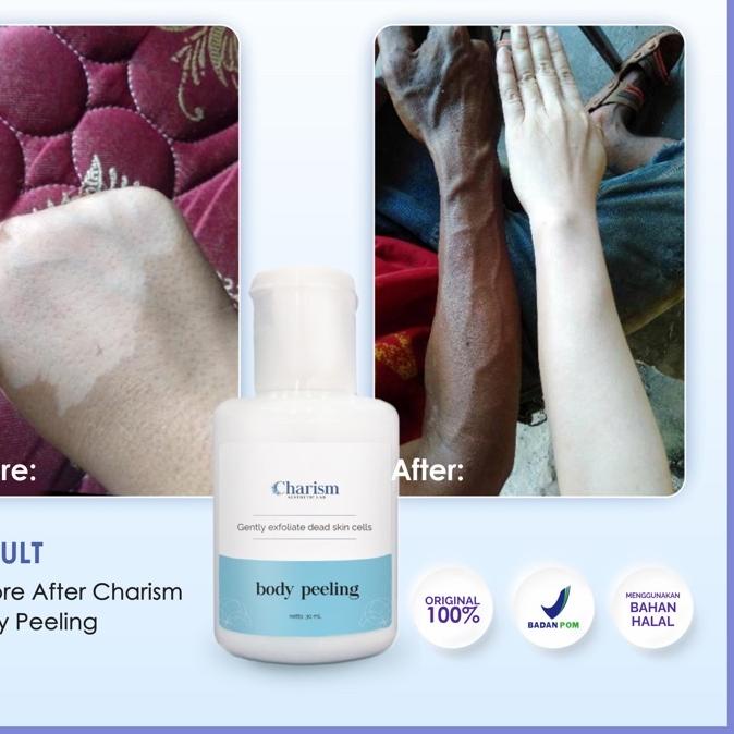 ❋ AHA 10% - BODY PEELING SOLUTION - PENGELUPASAN KULIT BADAN ♡