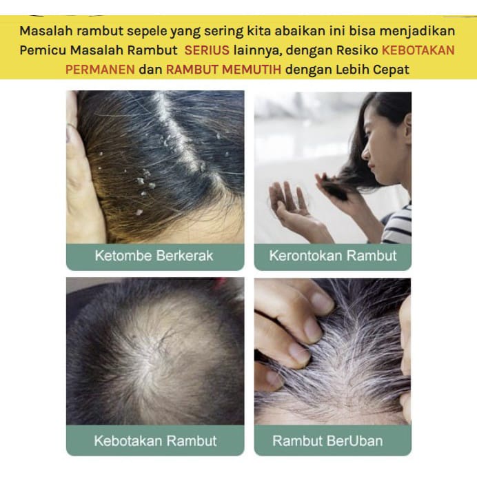 Smuuty Hair Treatment Serum Kemiri Bakar 100% Herbal BPOM | Mengatasi Rambut Rontok Penghilang Uban Perawatan Penyubur Rambut | ORI