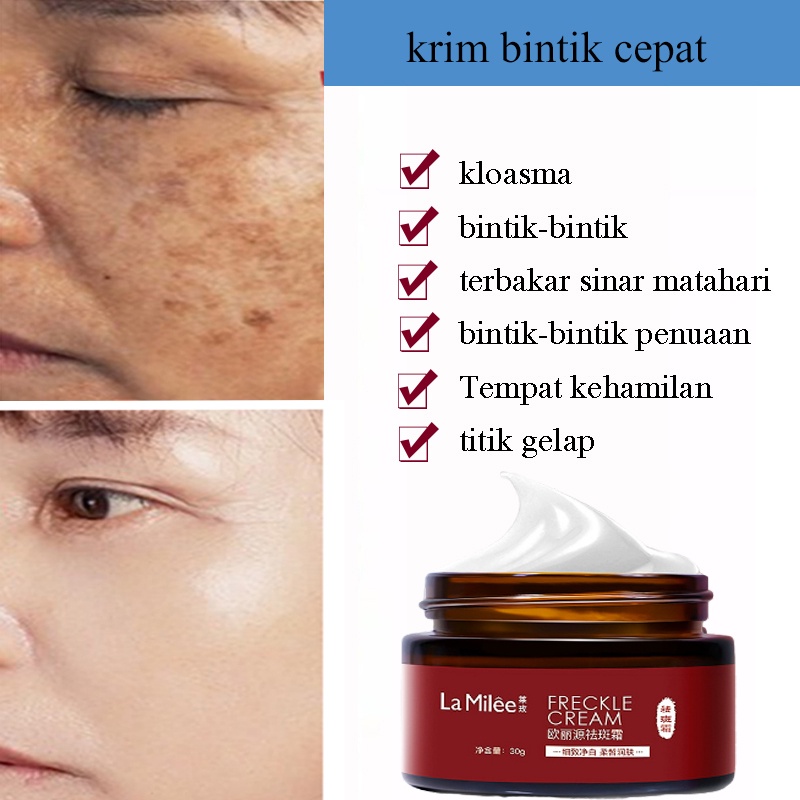 La Milee Krim Bintik Cream Penghilang Flek Hitam Salep Melasma Flek Hitam Ampuh Efektif Krim Penghilang Bintik-bintik 30Gr Hight Whitening Freckles Cream