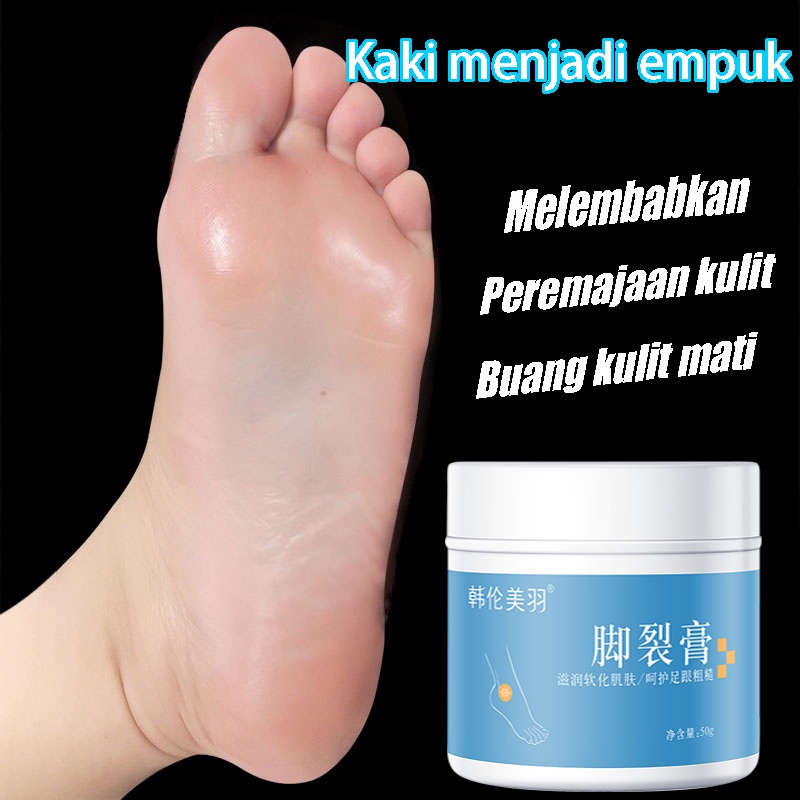 Obat Kaki Pecah Dan Kering Foot Cream Cream Krim Masker Penghilang Kaki Pecah Dan Kering 50g / cream untuk kulit kaki pecah-pecah /Perawatan Kaki Penghalus Tumit