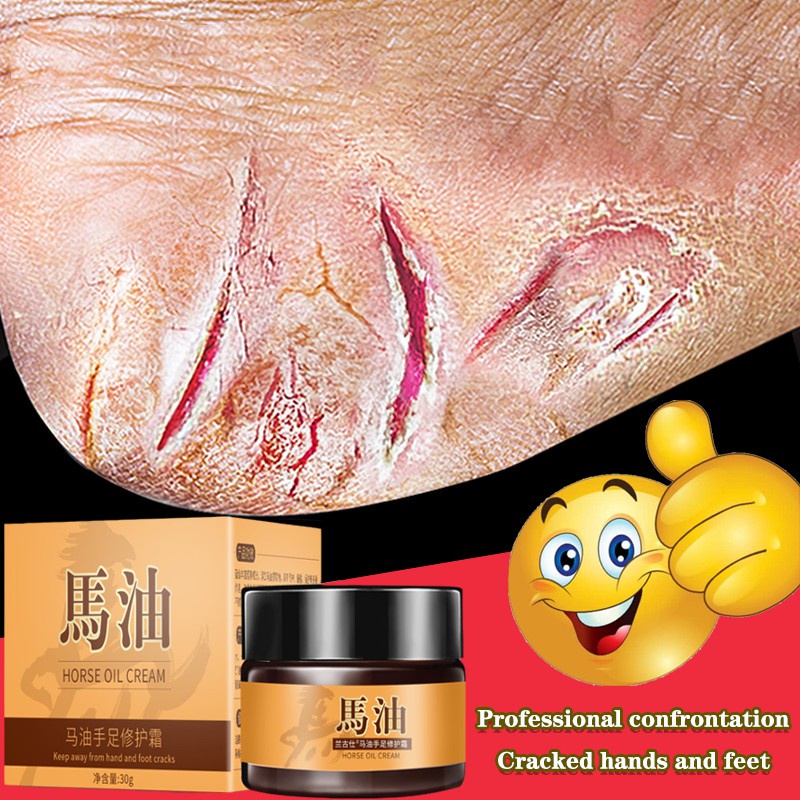 Krim kaki tangan Krim kaki pecah pecah Pemutih tangan dan kaki Minyak kuda tangan dan kaki retak Tumit kering dan pecah-pecah Tumit pecah-pecah Anti-retak Retak dan pecah-pecah Krim penyembuhan perawatan kaki