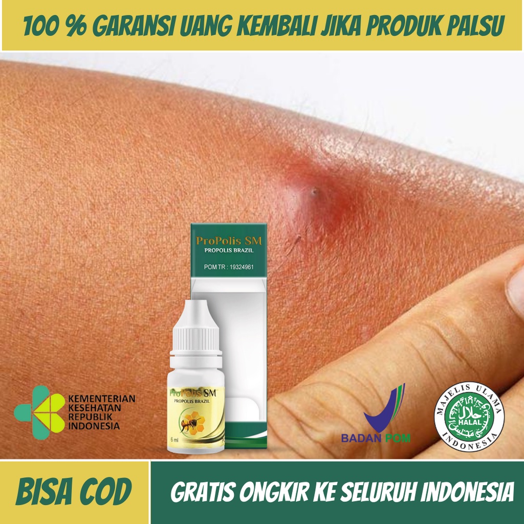 Obat Bisul Bayi Anak dan Dewasa, Obat Bisul Di Pantat, Obat Bisul Bernanah Di Kelamin, Obat Bisul Be