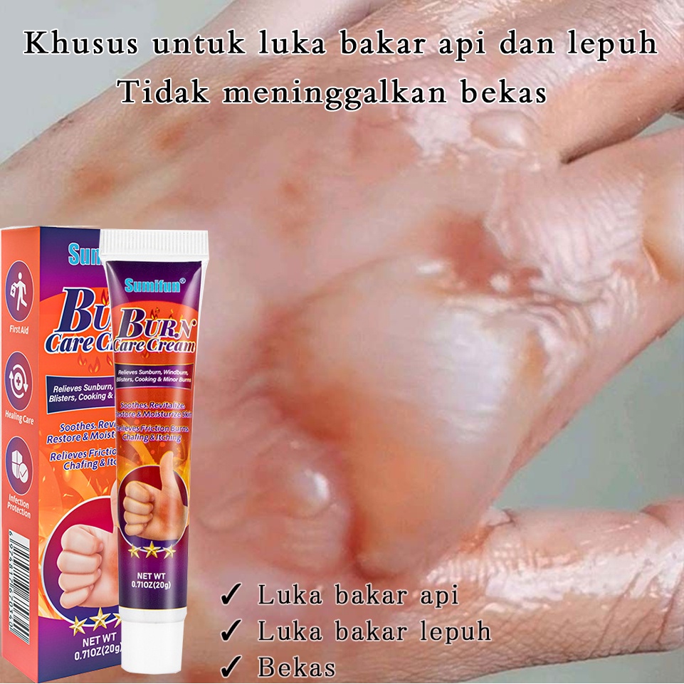 [COD ] Bakteri perawatan luka bakar , krim luka bakar, krim luka bakar, krim pemaikaian luar untuk k