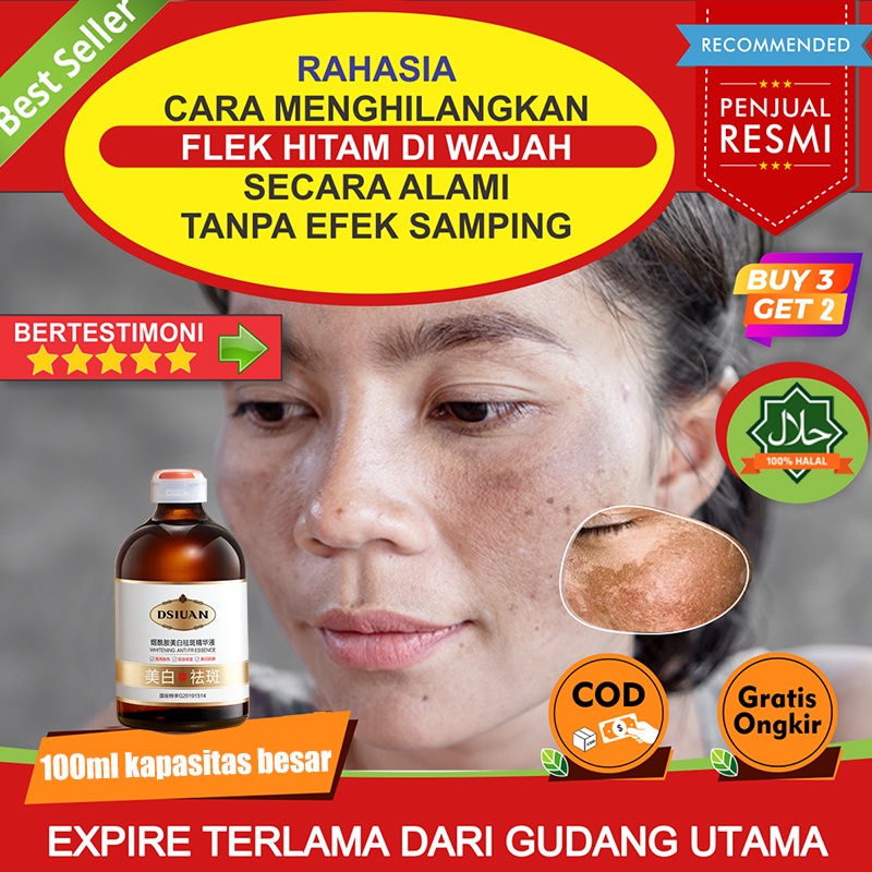 Niacinamide Pemutih Serum Penghilang flek Serum 100ml serum penghilang flek hitam yang ampuh Bintik Efektif Brightening Serum Flek Hitam Melasma Membandel Pencerah Wajah utuk Cerahkan Kulit Sensitif Kusam  Pigmen Gelap Melanin