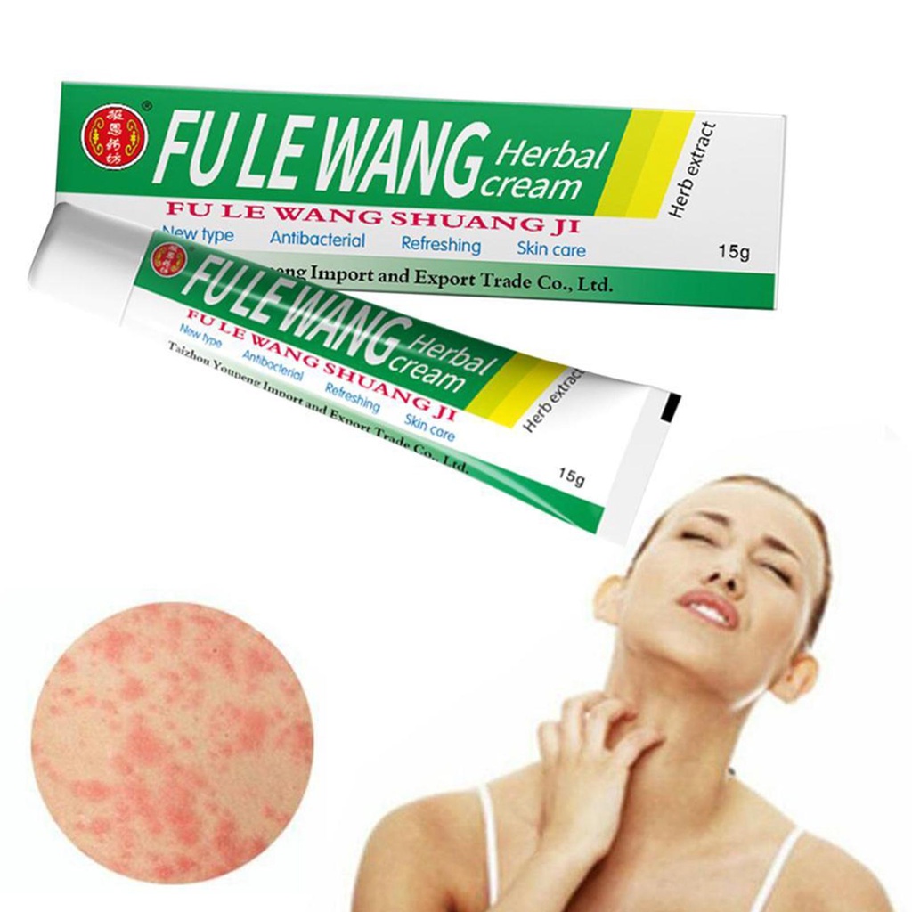 Herbal China Varises Psoriasis Cream Dermatitis Eksim Gatal