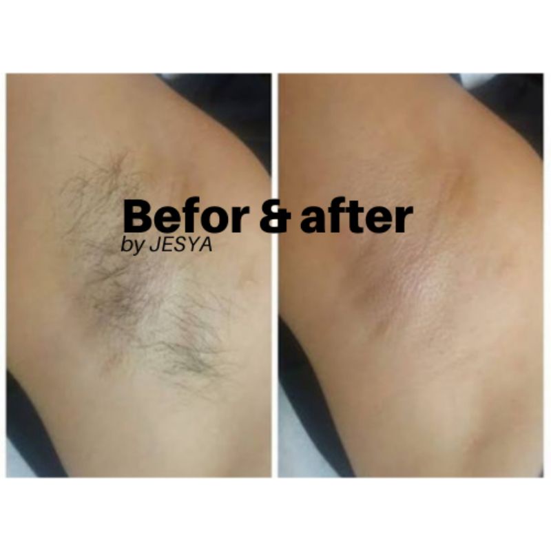 (JESYA ) SUGAR WAXING TANPA MEMANASKAN PREMIUM FREE AFTER WAX + 5 KAIN WAX &amp; SPATULA - WAXING KETIAK - WAXING BULU